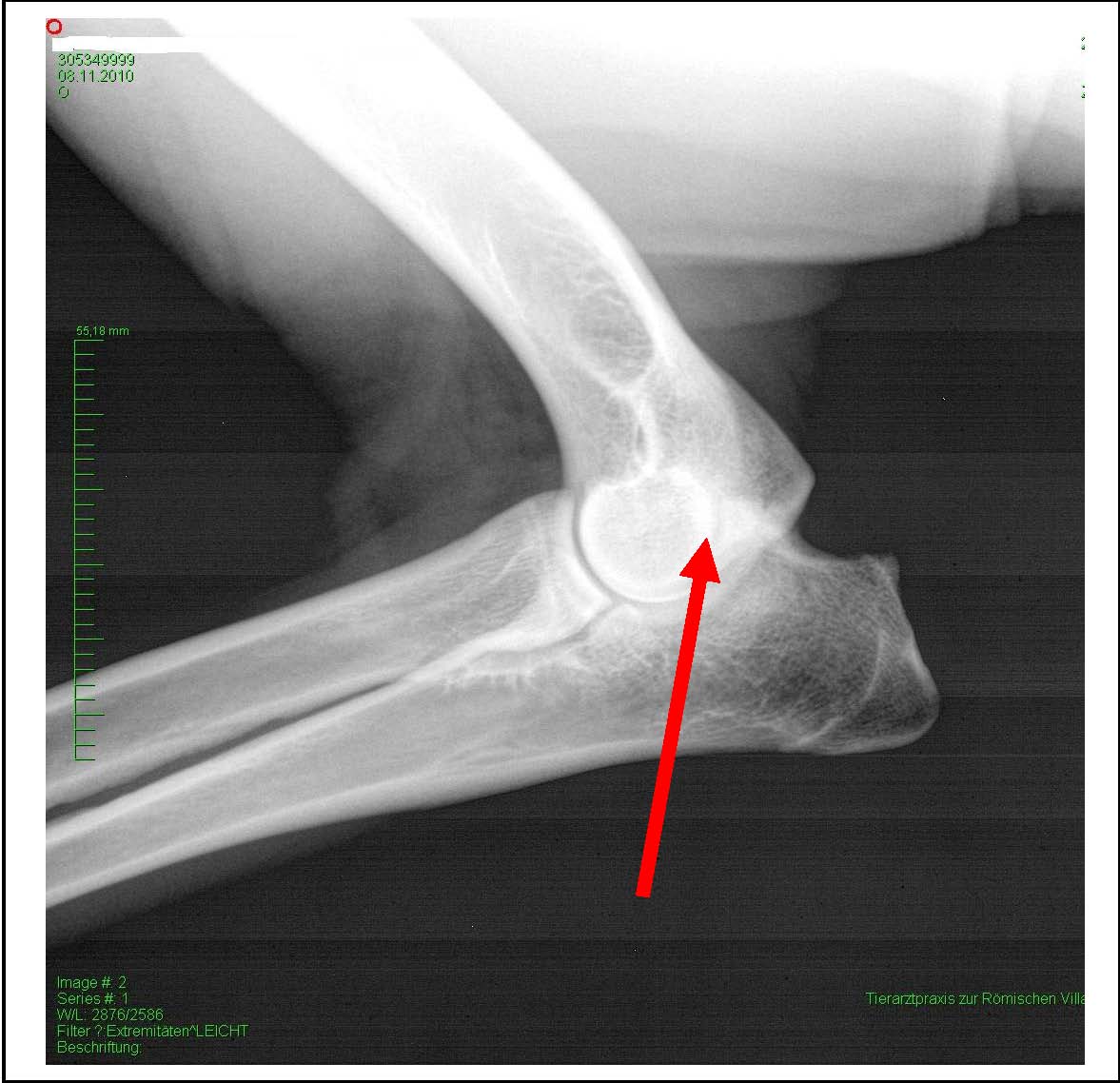 Thema: Arthrose